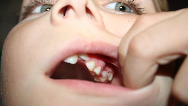 Students 'health at risk' as dental queue grows