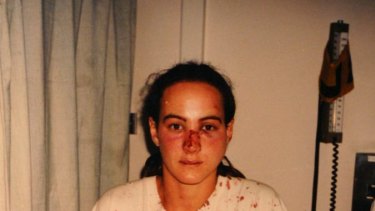 Corinna Horvath after being beaten in 1996.