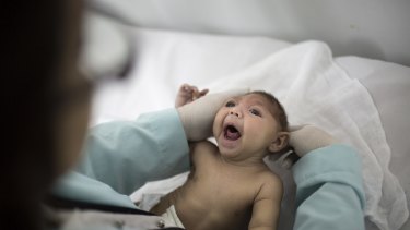 Lara was born with microcephaly in a hospital in Brazil.  When indications mounted that the increase in microcephaly was connected to the Zika epidemic, the World Health Organization (WHO) declared an international emergency.