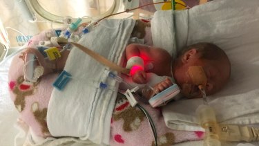 premature baby girl