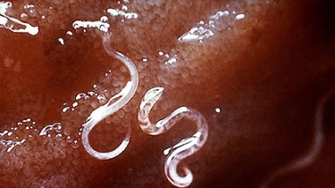 A study has show the hookworm, which burrows through the skin before travelling via the bloodstream to live in the gut, gives coeliacs an improved tolerance for bread.