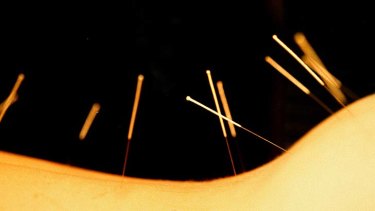 Acupuncture help: may assist with PCOS and menopause.