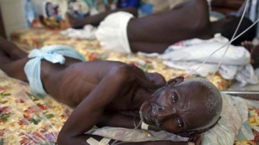 Image result for cholera patient
