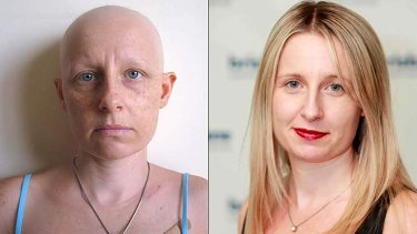 Brisbane Times reporter Kim Stephens during chemotherapy (left) and as she appears today (right).