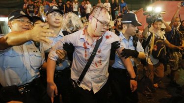 Bloodied, but unbeaten: Police take an injured man from the confrontation of pro-democracy student protesters and angry local residents in Mong Kok, Hong Kong.
