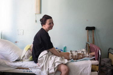 Çernihiv'de bombardıman sırasında yaralanan 44 yaşındaki Natalya Vakula.