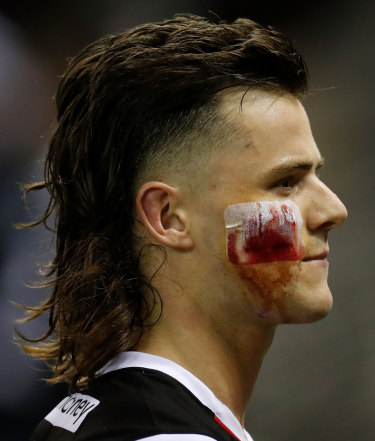 Battered and bruised: St Kilda’s Jack Sinclair.