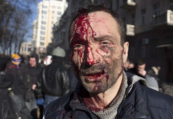 A man looks on after being injured in clashes between anti-government protesters with Interior Ministry members in Kiev, February 18, 2014. Ukrainian riot police advanced on the heart of 12-week-old protests against President Viktor Yanukovich on Tuesday and security forces set a deadline to end disturbances after at least five protesters were reported killed in a day of clashes.
