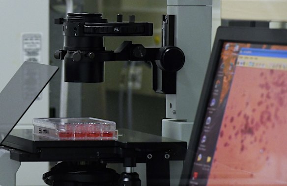 A sample of the COVID-19 Omicron variant is analysed for an antibody reaction.