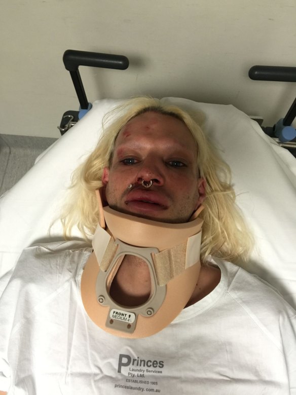 Danny Levi Bryce-Maurice suffered a broken nose in the assault and spent the night in hospital.