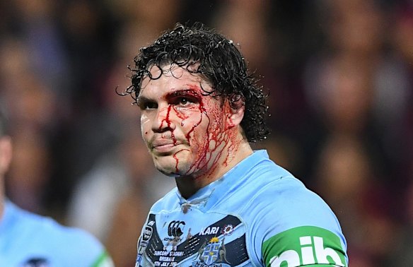A bloodied James Roberts of the Blues.