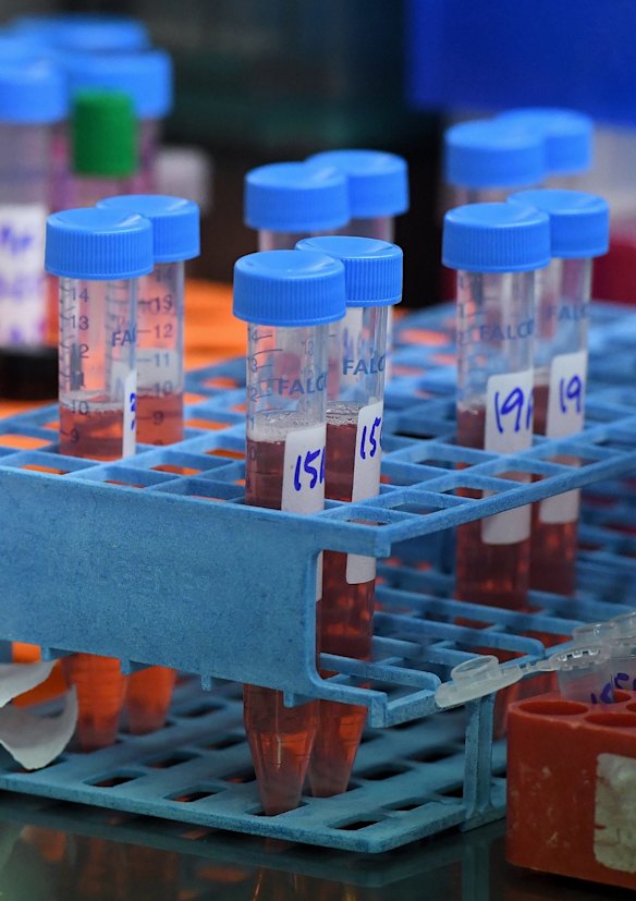 The thawing of frozen cells from parents and children, to look at their immune response to COVID-19, at St Vincent's Centre for Applied Medical Research, Darlinghurst.