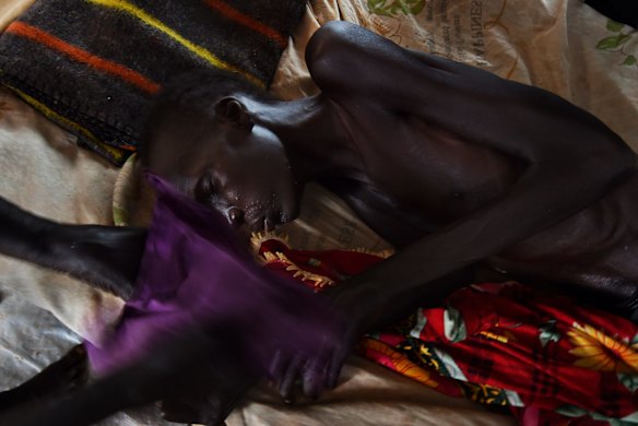 Nyabol Gatgoak keeps flies away from her son TB patient Duoth Dhol 38 who is also suspected to have HIV as he undergoes treatment for TB in the Medecines Sans Frontieres Bentiu Protection of Civilian's hospital UN Bentiu PoC, Unity State, South Sudan.