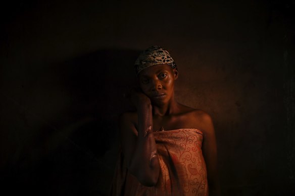 Naomiah Ngalula, 40, was cut on the arm and neck with a machete by Bana Mura militia men when her village was attacked. 