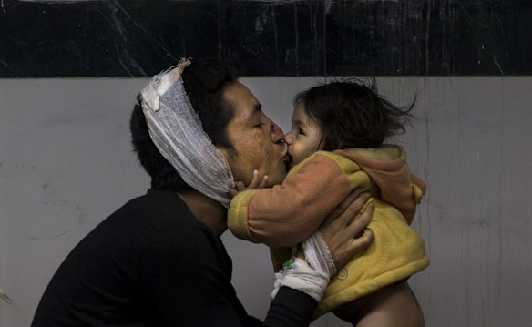 Earthquake injured Nepalese man Suresh Parihar plays with his daughter Sandhya at a hospital, in Kathmandu, Nepal, Sunday, April 26, 2015.