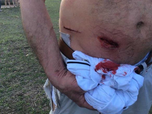 Another man sustained a deep gash to his stomach after being attacked by a kangaroo in the grounds of Morisset Hospital, also in March.