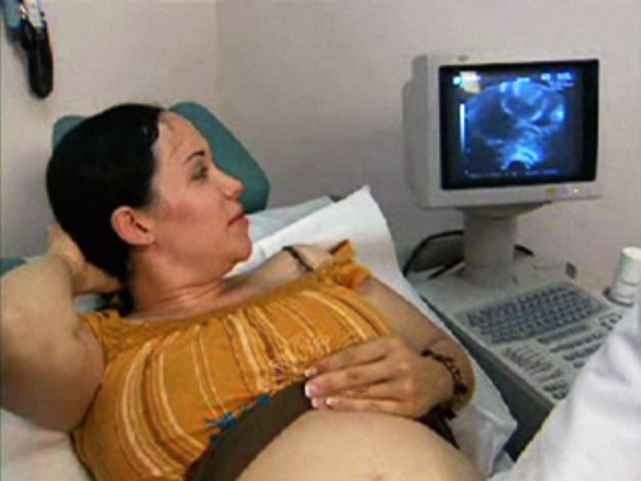 This image made from a 2006 video provided by KTLA shows Natalie Suleman looking at a ultrasound of her unborn twins at an in vitro fertilisation clinic in Los Angeles.