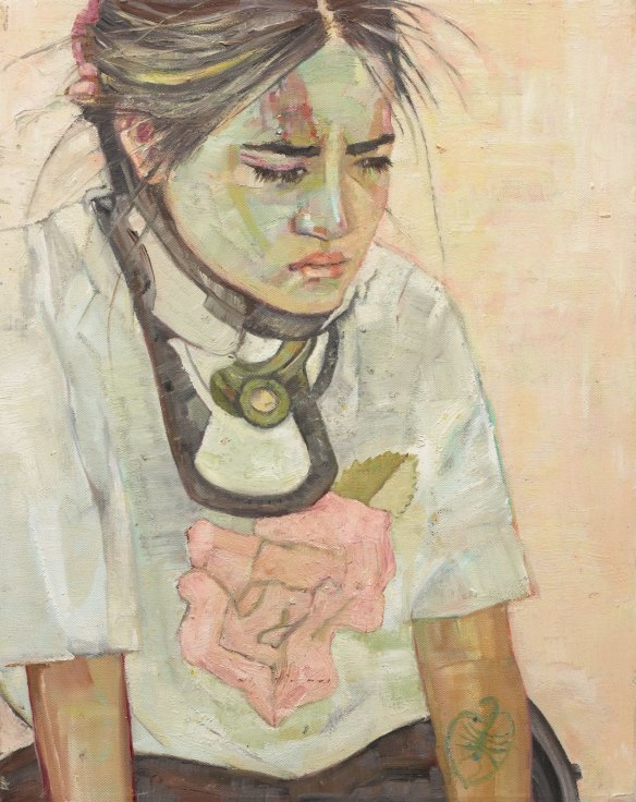 Pat Hoffie was highly commended for her portrait of her daughter Visaya in a c-collar.