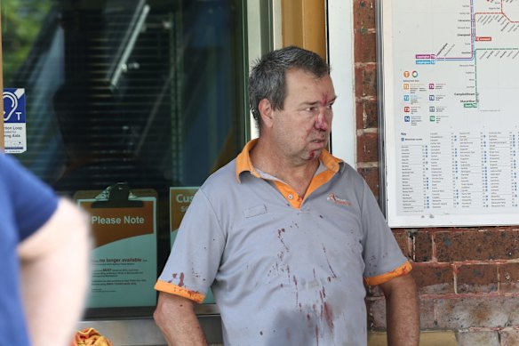 Injured leave the station after a train hit a buffer at Richmond Station. 