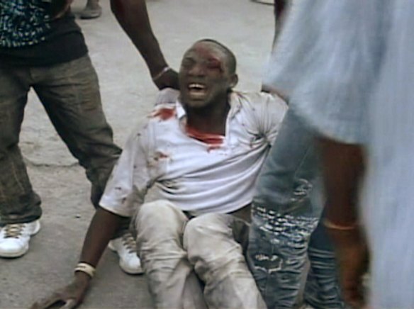 An earthquake victim in Port-au-Prince.