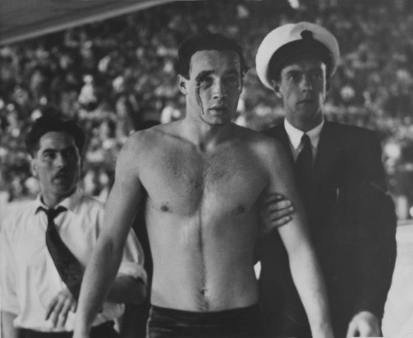 Ervin Zador, Hungarian water polo player, injured in match between Russia and Hungary in the 1956 Olympic Games.