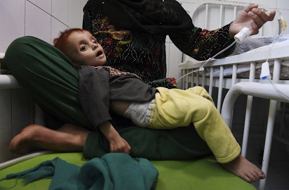 Saber aged 10 months old suffering from severe acute malnutrition is comforted by his mother Shahr Banoo aged 15 years whilst being treated at the Mofleh Pediatric Hospital in Shaidayee area outside Herat city.