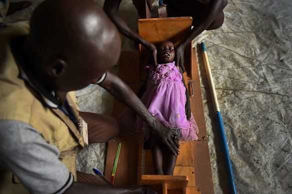 Nyalen Gatmai 2 yrs is measured at the CARE nutrition clinic at sector 5 inside the UN Bentiu Protection of Civilians (POC) site, Bentiu, Unity State, South Sudan. 