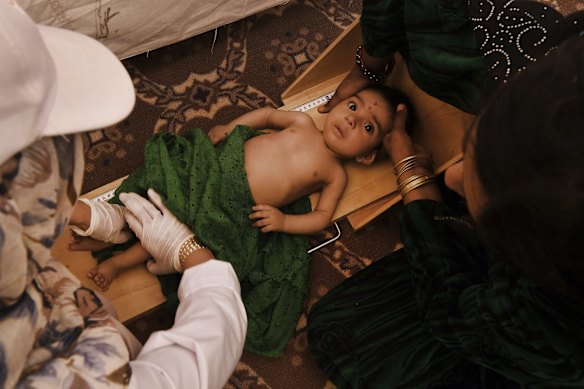 Qudratullah aged 7 months has his height measured in a nutrition centre in Regreshan IDP camp in Herat Province. Qudratullah is being treated for severe acute malnutrition.