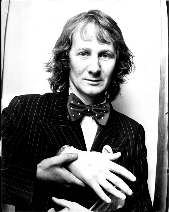 Durrant in  June, 1975, with his "severed hand" artwork.