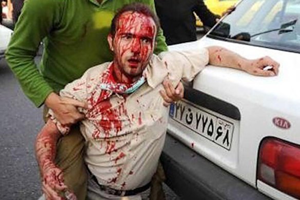 An injured man is helped in Tehran in this photograph made available June 21, 2009. Pro-reform clerics in Iran stepped up criticism of the authorities on Sunday after more than a week of unprecedented popular defiance against the leadership of the Islamic Republic.