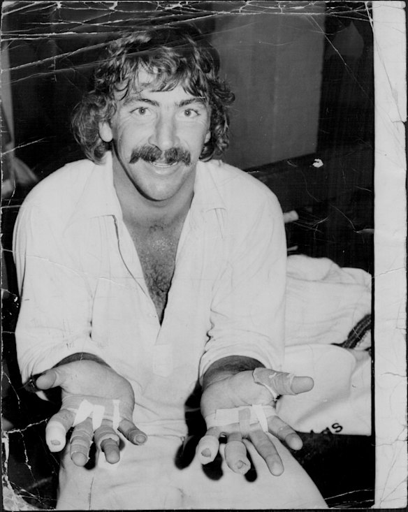 Fouth day of the fourth Test being played at the SCG. Australia vs England. Australian wicket keeper Rod Marsh display's bruised hands after today's test match. The taped-up battered hands from the deliveries of fast bowler Jeff Thomson and Dennis Lillee, January 1975.