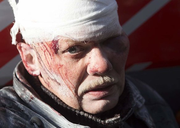 A man looks on after being injured in clashes between anti-government protesters with Interior Ministry members in Kiev, February 18, 2014. Ukrainian riot police advanced on the heart of 12-week-old protests against President Viktor Yanukovich on Tuesday and security forces set a deadline to end disturbances after at least five protesters were reported killed in a day of clashes.