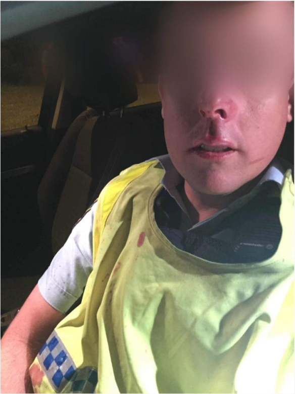 A police officer was left with a broken nose after an assault during a random breath test on New Year's Eve.