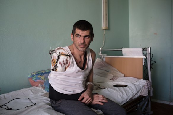 GRAPHIC CONTENT WARNING. Maksym Klymenko, aged 40, was injured near Hoholiv on March 15.