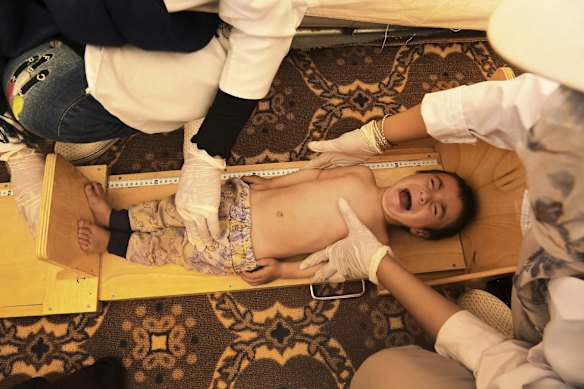 Sudis who is suffering from diarrhoea has his height measured during a consultation testing for malnutrition with medical staff at a medical facility in Regreshan IDP camp in Herat Province. The family had to flee Ghor province due to Taliban fighting and have been living in Regreshan IDP camp for the past 9 months.