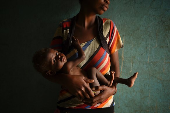 Bilonda Betu holds her malnourished son Betu Nkashama, 10 months and weighing 4kg, as they wait to see a doctor at the Moyo Health Centre in Tshimbulu village.
