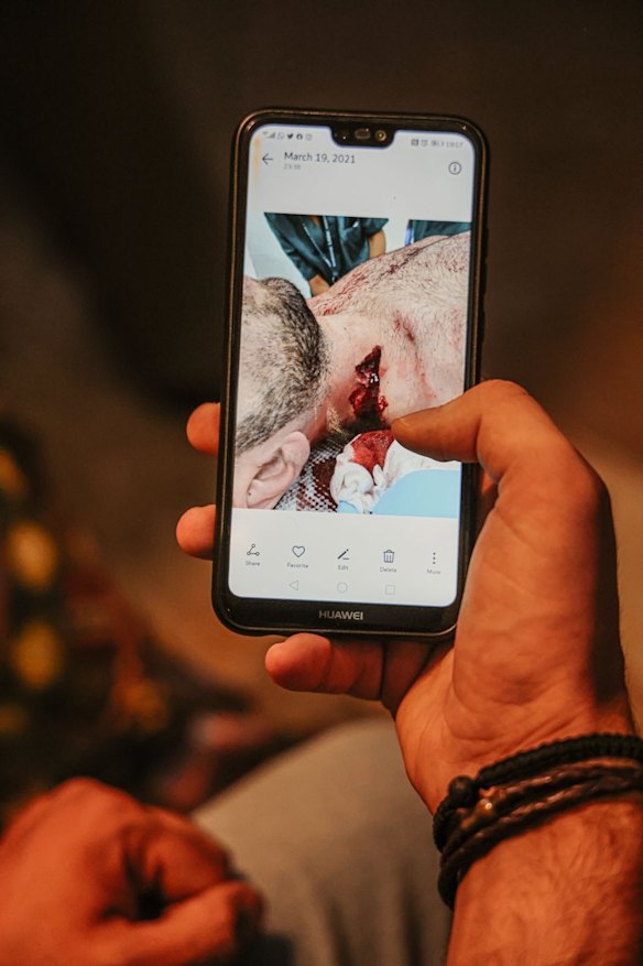 Amin Timani, 28, volunteered to clean up the river of glass and debris choking Beirut’s streets following last year’s explosion and has helped hundreds of impoverished families since. For his troubles, the graphic designer was shot at close range with a rubber bullet during a protest seeking justice for the 218 people killed, 7000 injured and 300,000 rendered homeless by the port disaster. Blood spurted from Timani’s neck before he placed a hand over the wound and staggered to the nearest Red Cross centre. “I thought if I sit down I’m going to die because no one will have the courage to come and help me.”