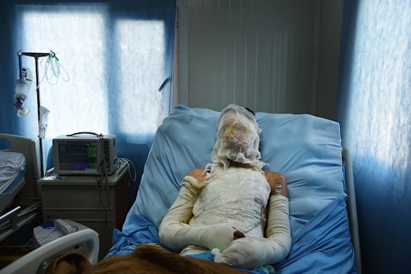 Abdulrahman Abdulaaly is being treated for burns. His two brothers were killed in two separate incidents in West Mosul under the Islamic State. 