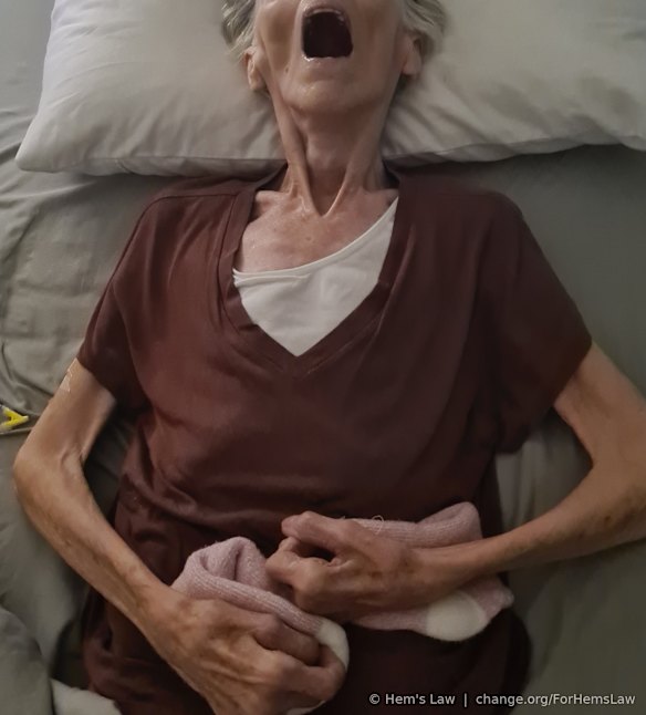 As his Alzheimer's progressed, Hem lost his ability to swallow and eventually became unable to move, eat or drink. He spent about two weeks in this state before he died.