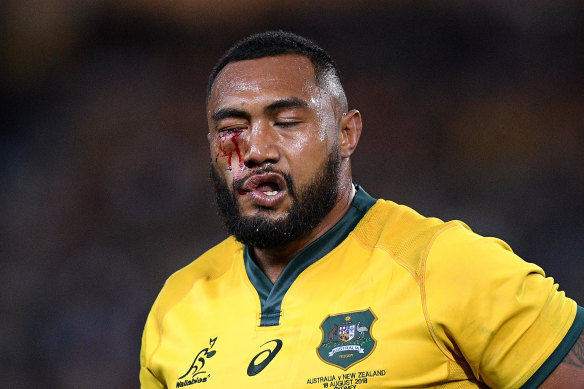 Sekope Kepu of the Wallabies leaves the field with a cut to the face.