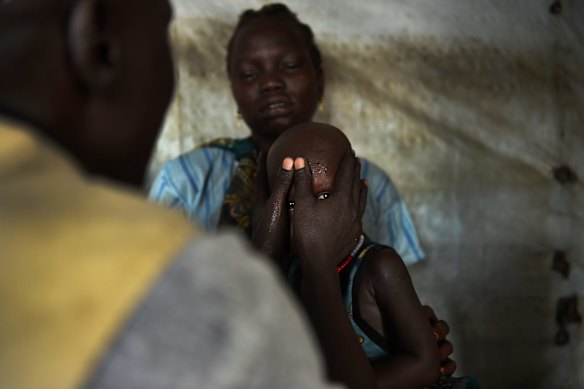 A child is tested for malnutrition at the CARE nutrition clinic at sector 5 inside UN Bentiu Protection of Civilians (POC) site, home to over 100,000 people who have fled violence and food insecurity. 