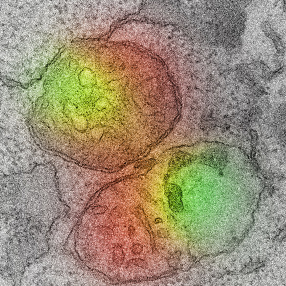 Two mitochondria, in red, undergoing herniation - the release of DNA (in green). If you look really closely you will see that the left half of the lower mitochondria has two membranes, but on the right, there is only one left as the mitochondria disintegrates.