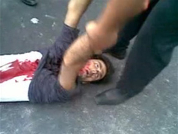 An injured man is assisted in Tehran in this undated photo uploaded onto Twitter June 21, 2009.  Iranian opposition leader Mirhossein Mousavi urged his supporters on Sunday to continue their protests over a disputed presidential election, in a direct challenge to the leadership of the Islamic Republic.