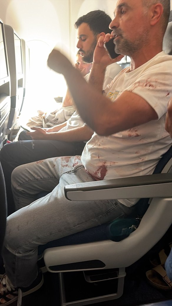 Passenger Yaniv Hayoun, with blood on his shirt after subduing the attacker.