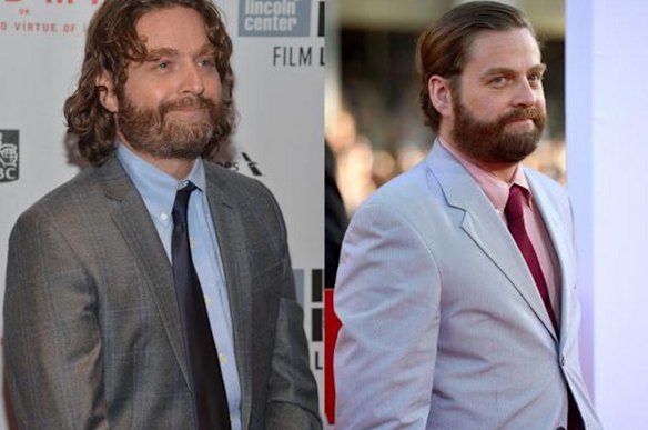 7 celebs whose faces have changed