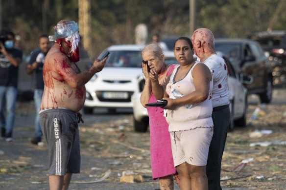 Injured people stand after a massive explosion in Beirut, Lebanon.