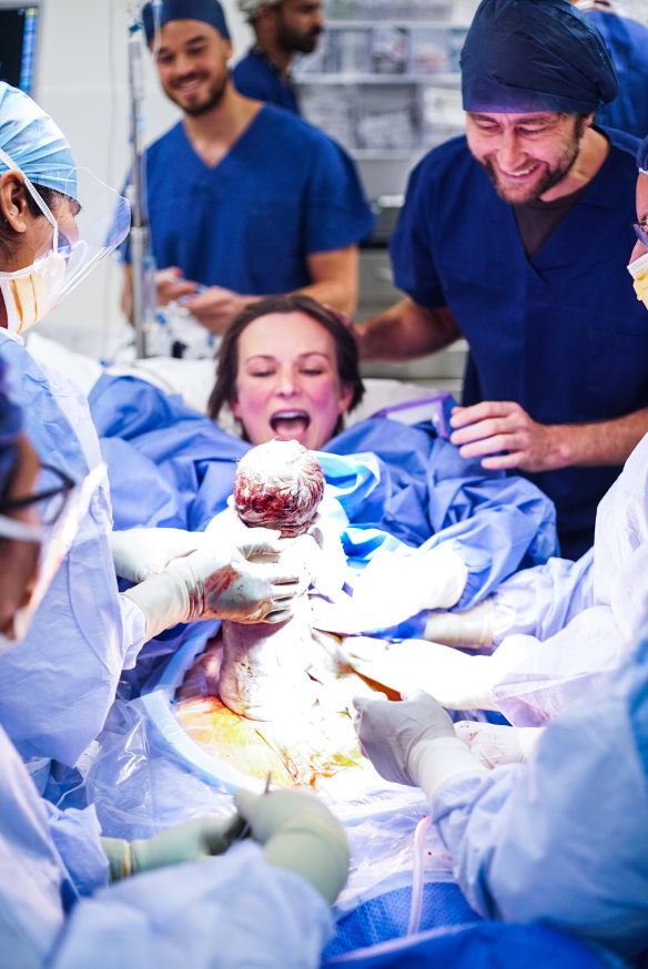 Mother Bec Secomb delivering her baby girl Lulu at Northern Beaches Hospital.