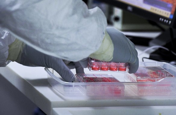 A COVID-19 Omicron variant sample to analyse antibody reaction with the Omicron variant, at St Vincent's Centre for Applied Medical Research, Darlinghurst.