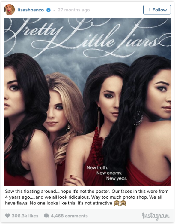 Actress Ashley Benson wasn’t on board with the images ABC Family had used to promote Pretty Little Liars. “Saw this floating around…hope it’s not the poster. Our faces in this were from 4 years ago…and we all look ridiculous,” she wrote. “Way too much photo shop [stet]. We all have flaws. No one looks like this. it’s not attractive.”