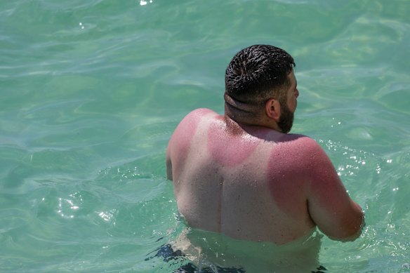 A man feels the burn during Australia Day celebrations at Bronte Beach.